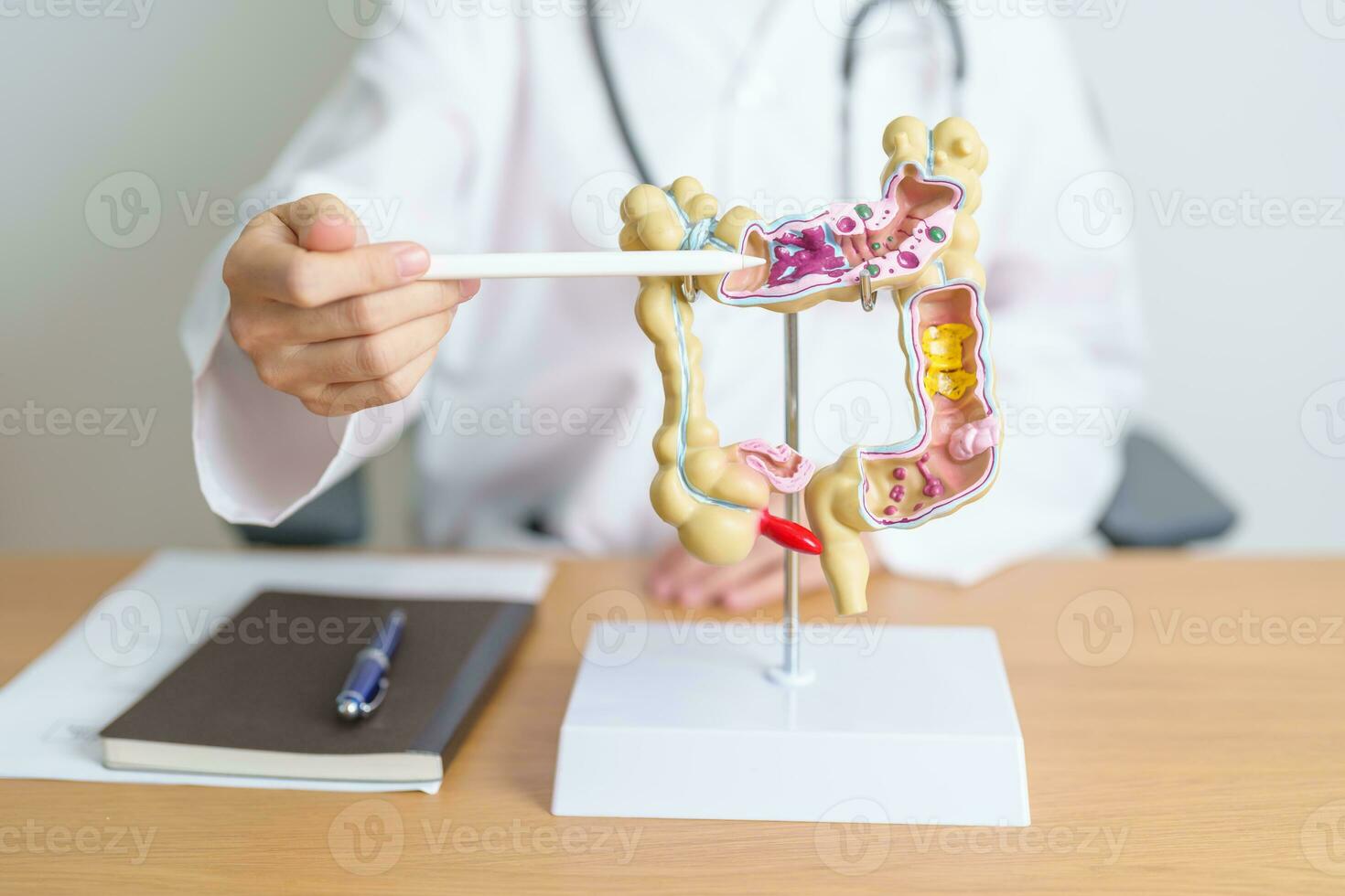 médico con humano colon anatomía modelo. colónico enfermedad, grande intestino, colorrectal cáncer, ulcerativo colitis, diverticulitis, irritable intestino síndrome, digestivo sistema y salud concepto foto