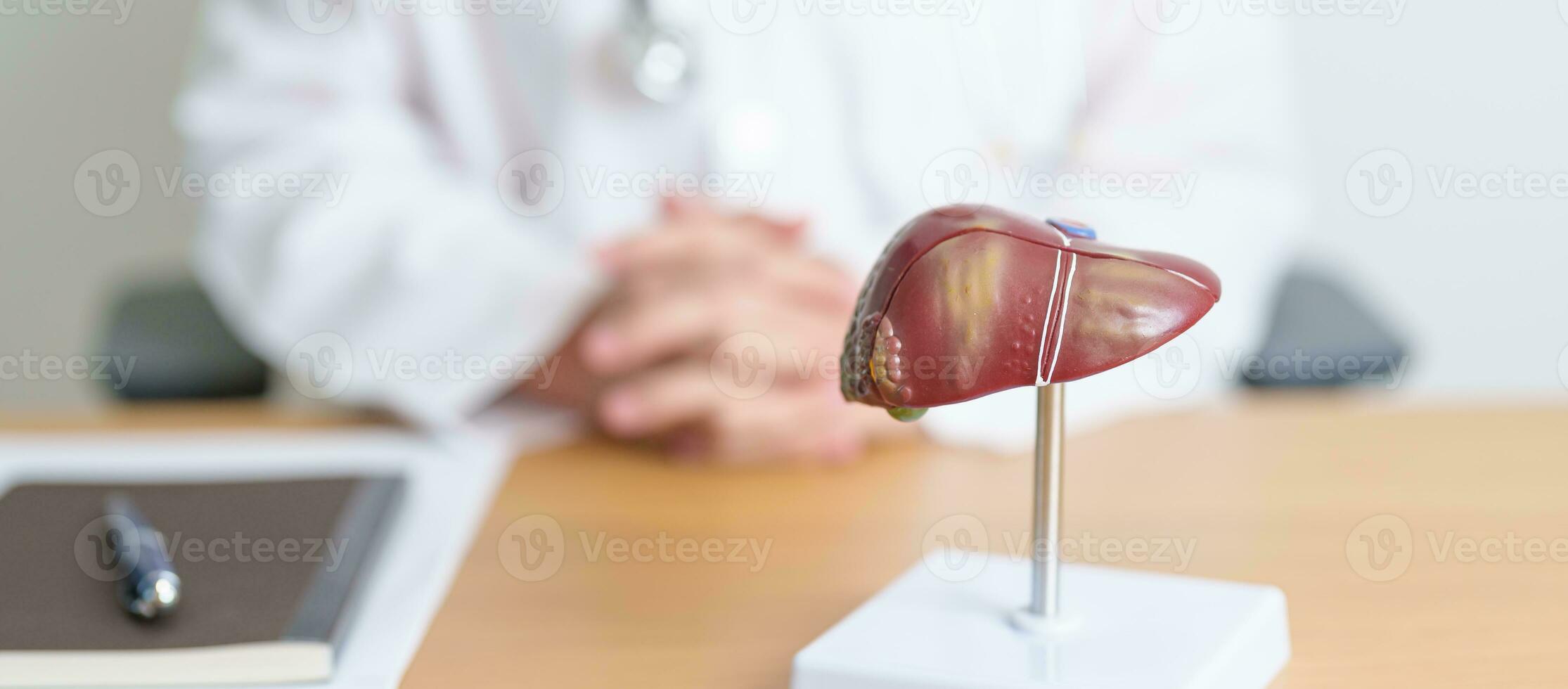 Doctor with human Liver anatomy model. Liver cancer and Tumor, Jaundice, Viral Hepatitis A, B, C, D, E, Cirrhosis, Failure, Enlarged, Hepatic Encephalopathy, Ascites Fluid in Belly and health concept photo