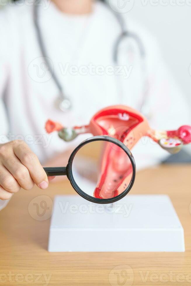 Doctor with Uterus and Ovaries anatomy model and magnifying glass. Ovarian and Cervical cancer, Cervix disorder, Endometriosis, Hysterectomy, Uterine fibroids, Reproductive system, Pregnancy photo