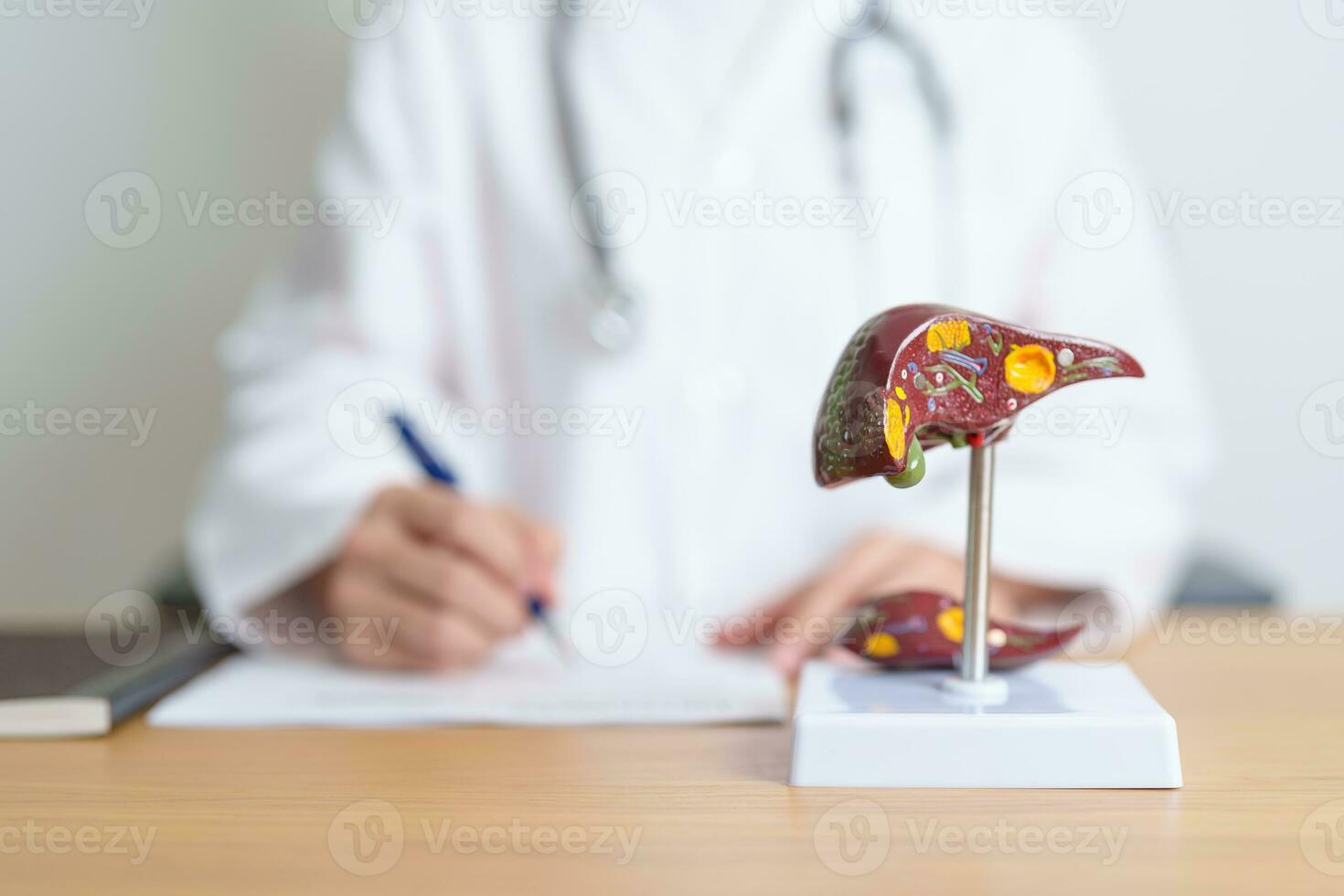 Doctor with human Liver anatomy model. Liver cancer and Tumor, Jaundice, Viral Hepatitis A, B, C, D, E, Cirrhosis, Failure, Enlarged, Hepatic Encephalopathy, Ascites Fluid in Belly and health concept photo