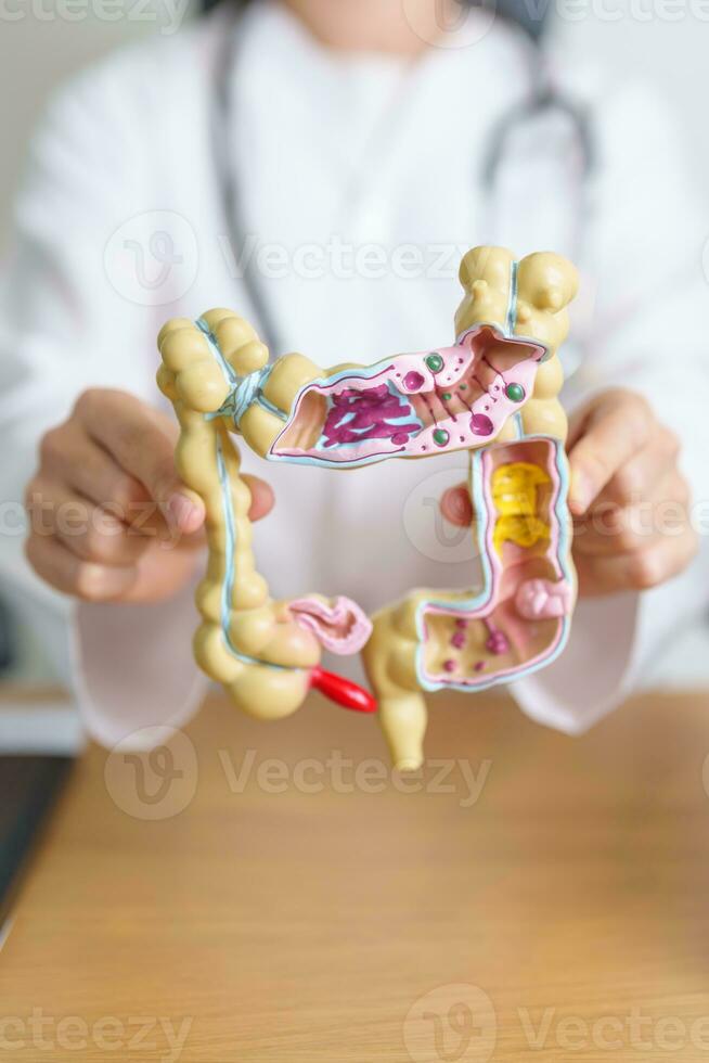 Doctor with human Colon anatomy model. Colonic disease, Large Intestine, Colorectal cancer, Ulcerative colitis, Diverticulitis, Irritable bowel syndrome, Digestive system and Health concept photo