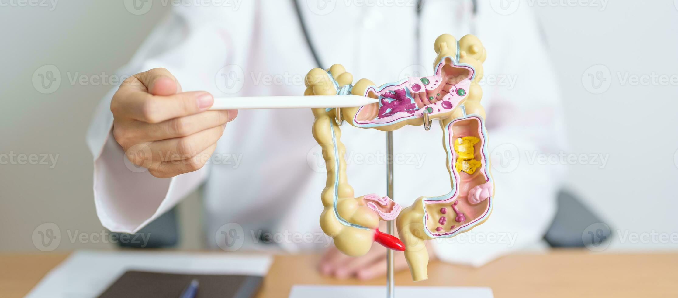 Doctor with human Colon anatomy model. Colonic disease, Large Intestine, Colorectal cancer, Ulcerative colitis, Diverticulitis, Irritable bowel syndrome, Digestive system and Health concept photo