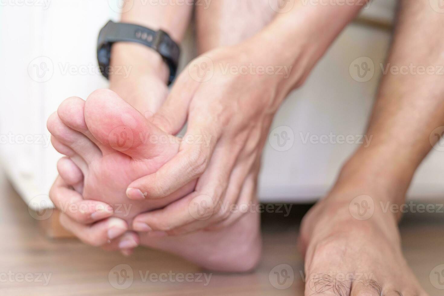 hombre que tiene juanetes en los dedos de los pies o ampollas debido al uso de zapatos estrechos y al despertar o correr durante mucho tiempo, dolor descalzo debido a la fascitis plantar. salud y concepto médico foto