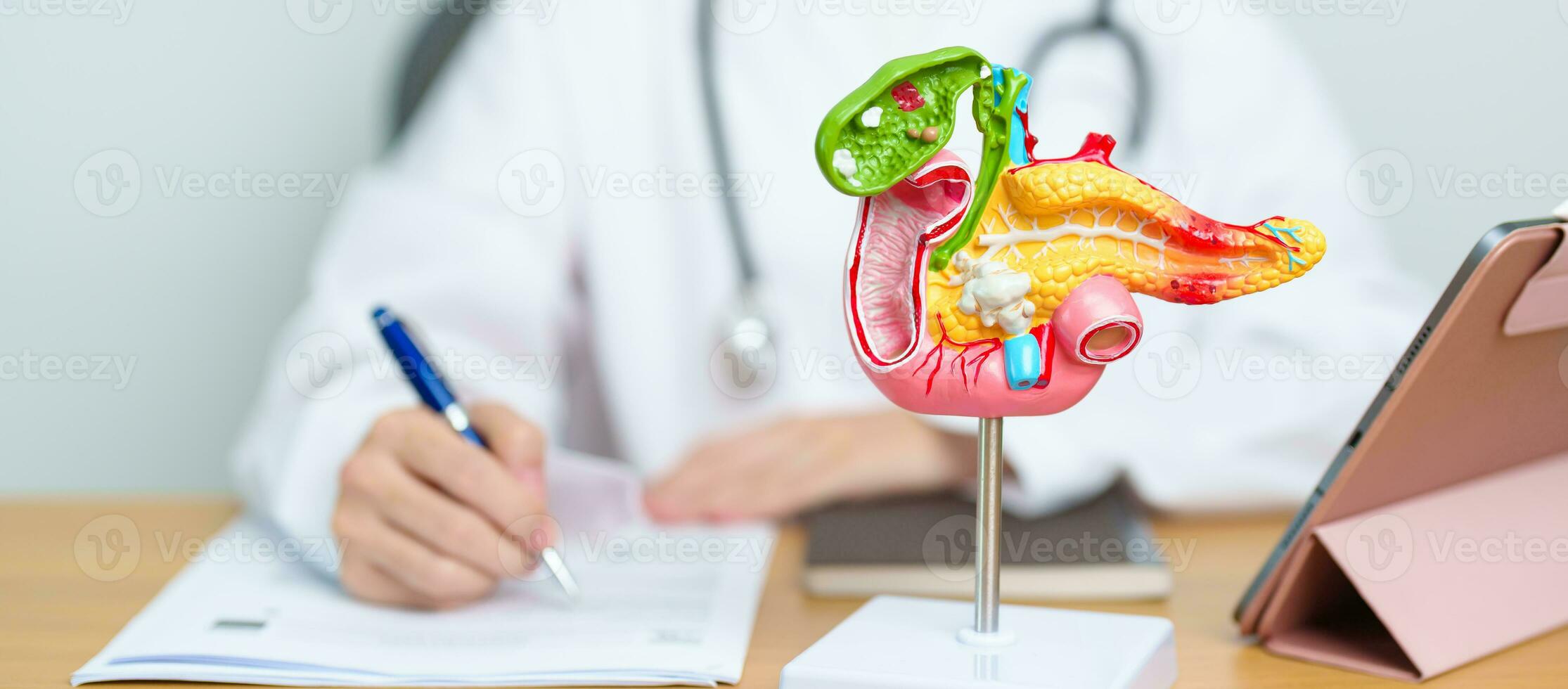 médico con humano pancreatitis anatomía modelo con páncreas, vesícula biliar, bilis conducto, duodeno, pequeño intestino y tableta. pancreático cáncer, agudo pancreatitis y digestivo sistema foto