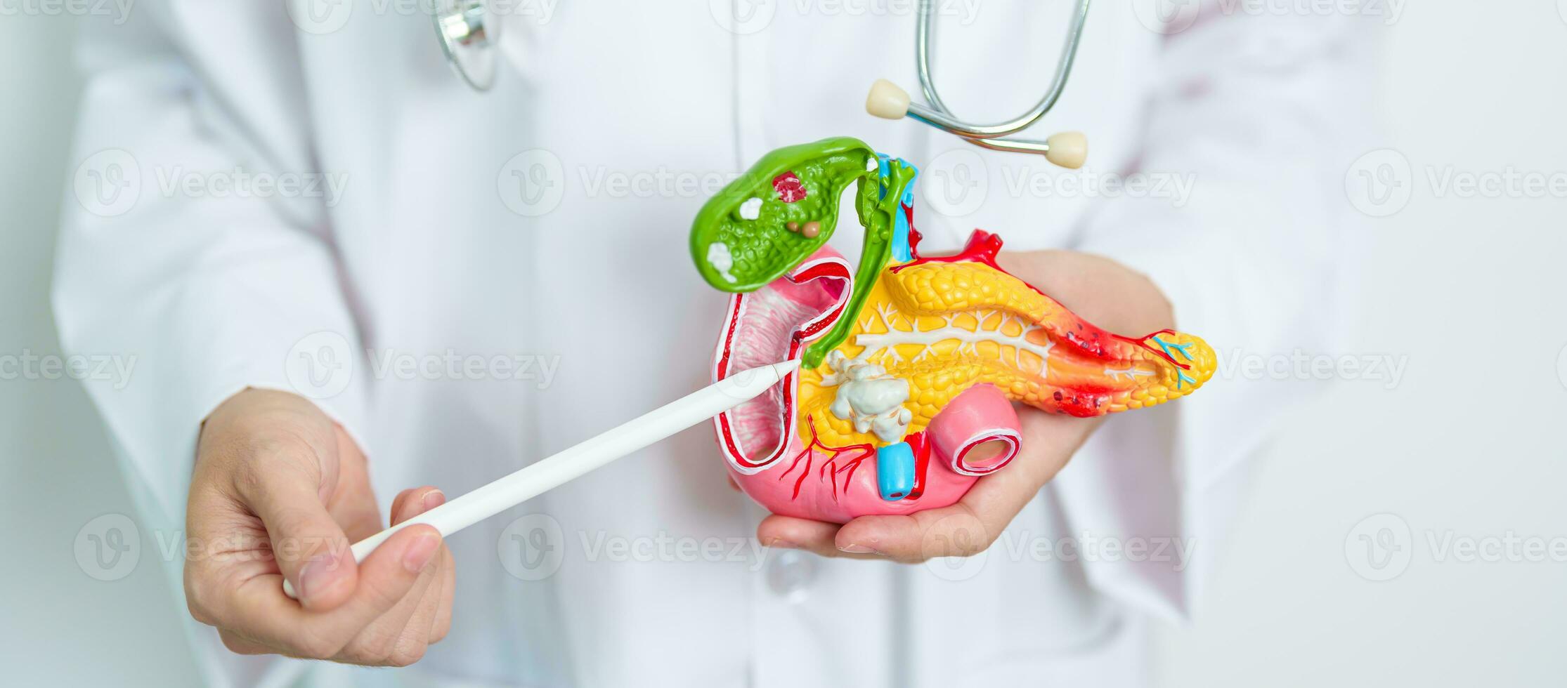 Doctor with human Pancreatitis anatomy model with Pancreas, Gallbladder, Bile Duct, Duodenum, Small intestine. Pancreatic cancer, Acute and Chronic pancreatitis,  Digestive system and Health concept photo