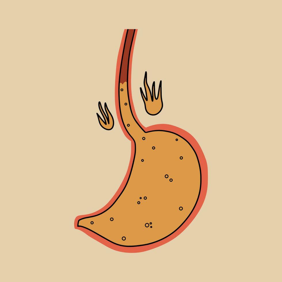 Stomach with gastric juice. Heartburn symptom. Vector illustration.