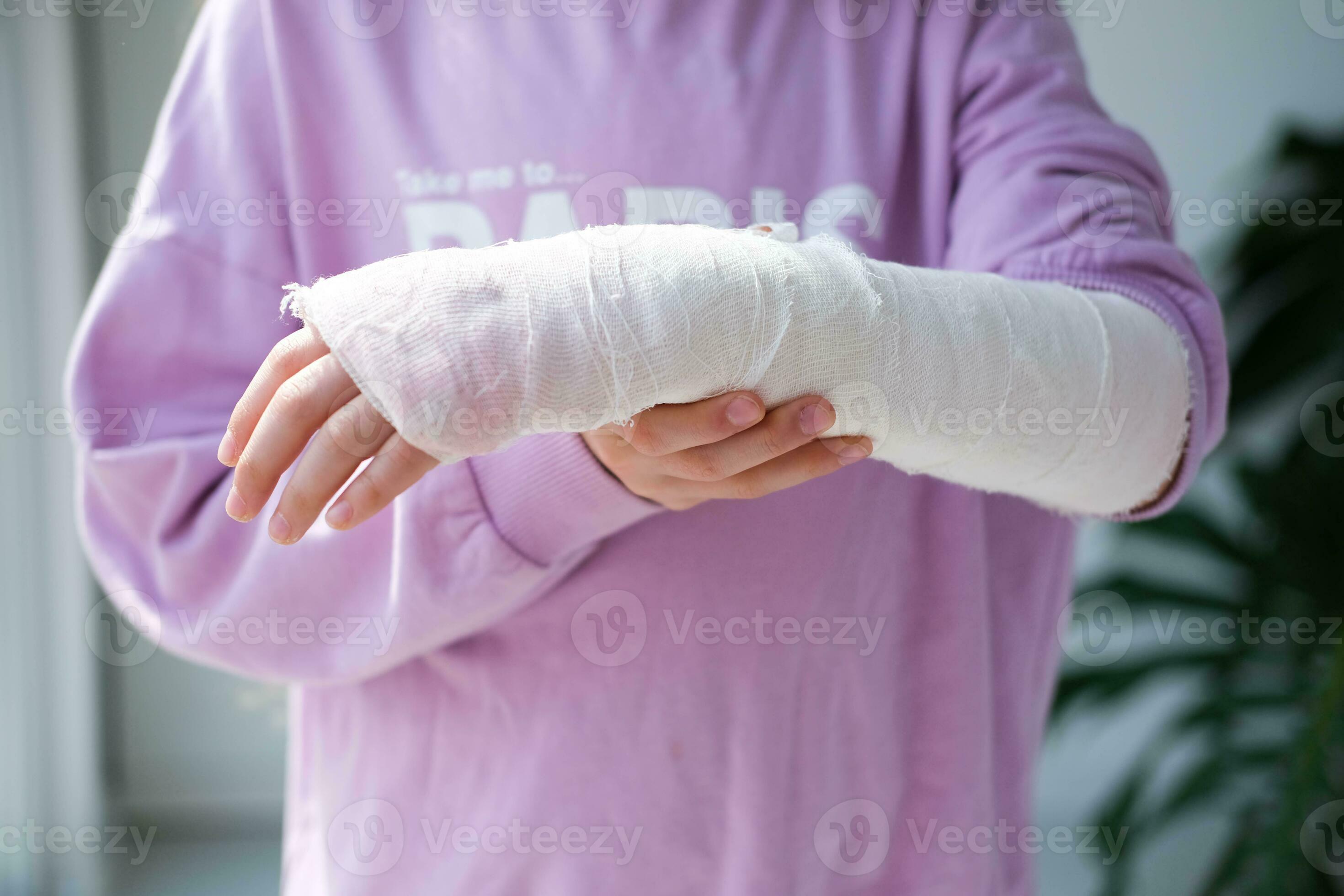 Close-up of a broken arm of a child in a cast. The girl holds her hand  folded against. A child with a plaster on his hand 25604600 Stock Photo at  Vecteezy