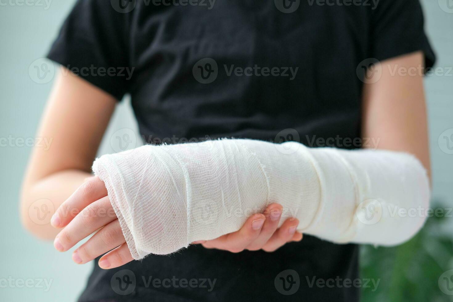 Close-up of a broken arm of a child in a cast. The girl holds her hand bent on the background of a black t-shirt. photo
