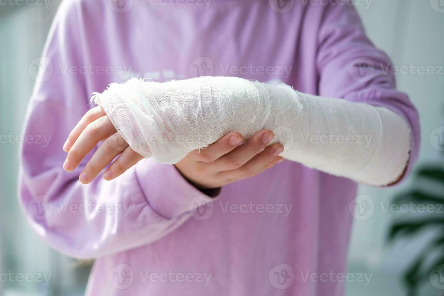 de cerca de un roto brazo de un niño en un elenco. el niña sostiene su mano doblada en contra . un niño con un yeso en su mano foto