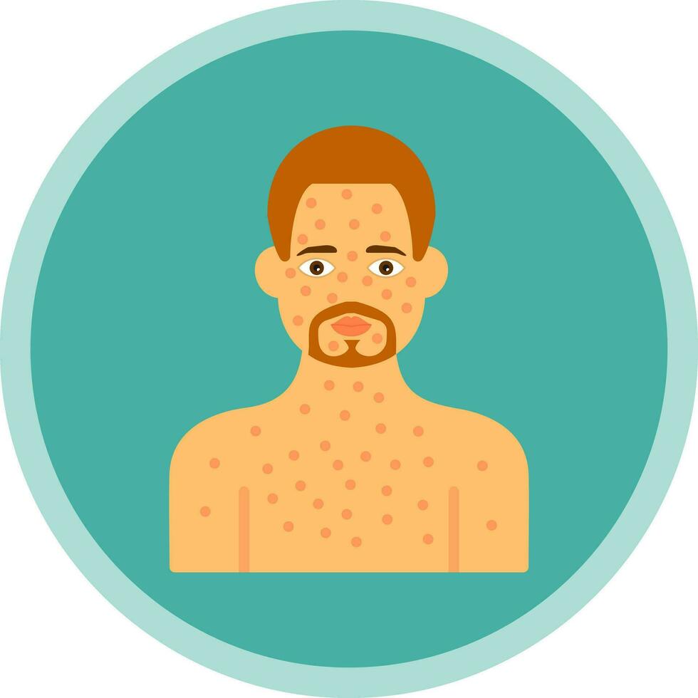 Anaphylaxis Vector Icon Design