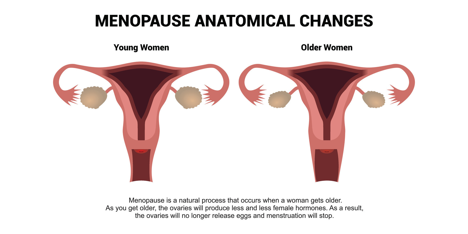 Menopause anatomical changes. Comparison of female reproductive system