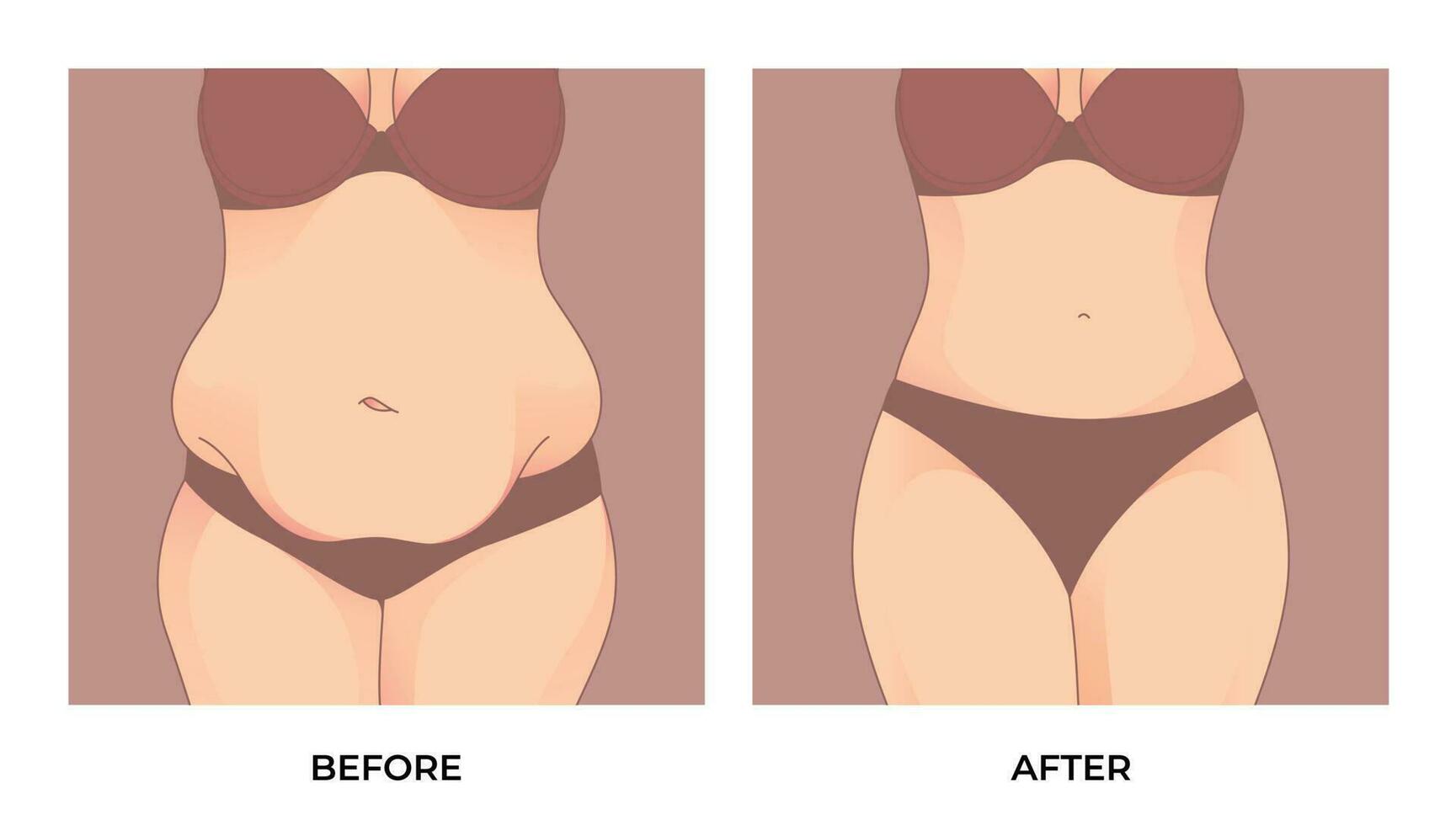 Belly fat. Before and after weight loss, woman body shape transformation, Fat To Fit. vector