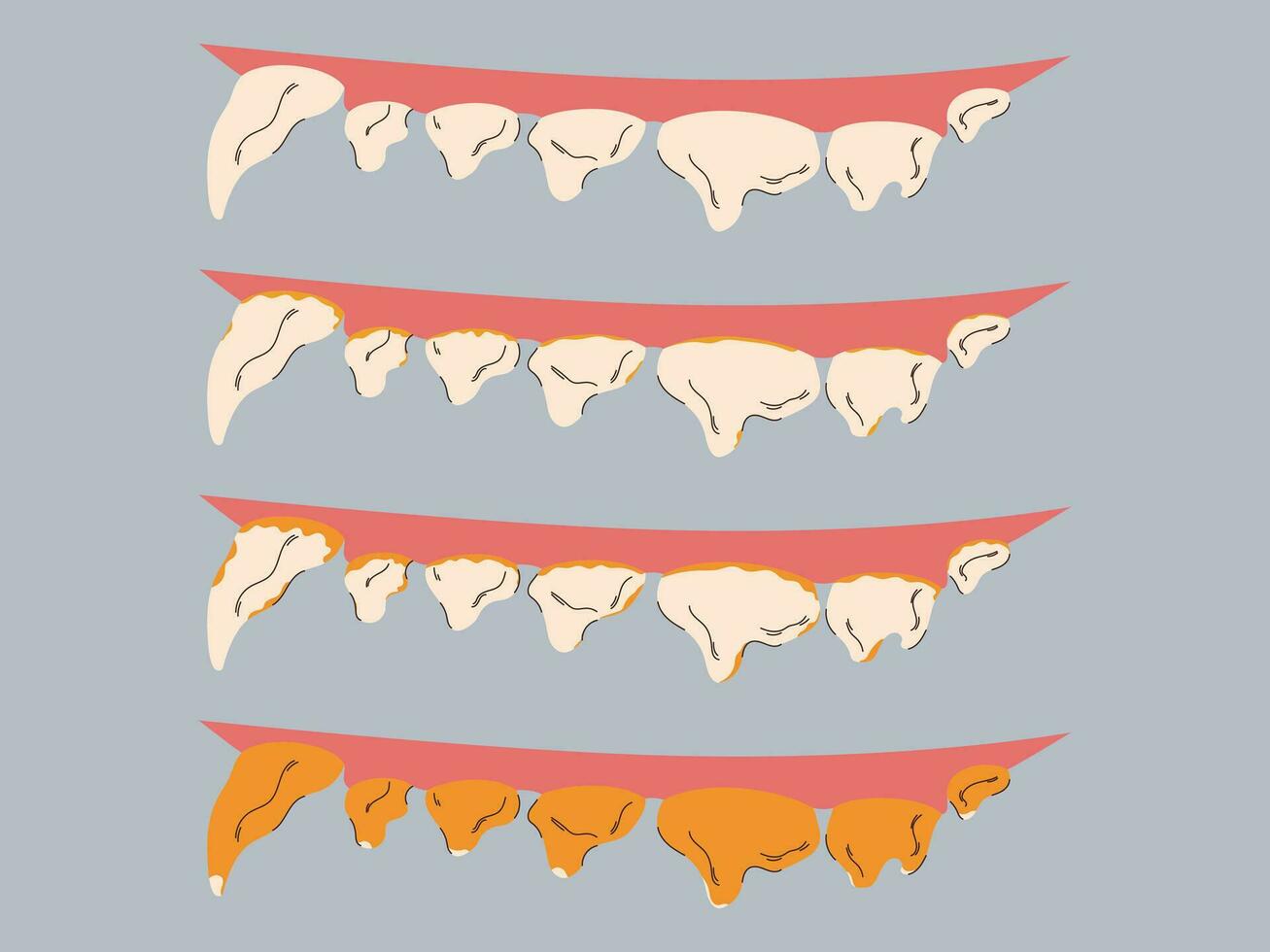 Stages of plaque and tartar formation in dogs. Gum disease prevention. Dog dental care concept. Vector illustration