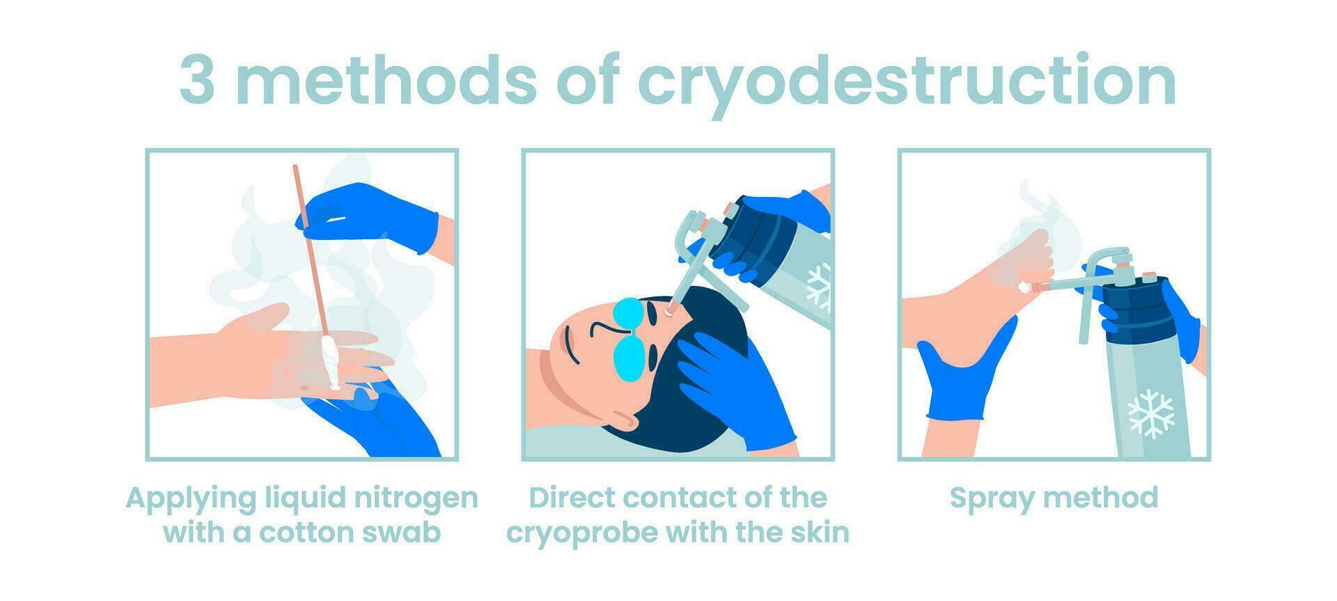 Methods of cryodestruction vector