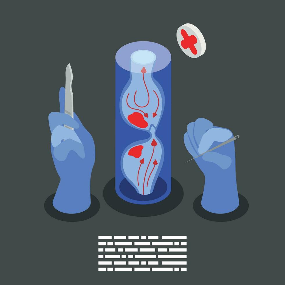 varicoso curación isométrica antecedentes vector