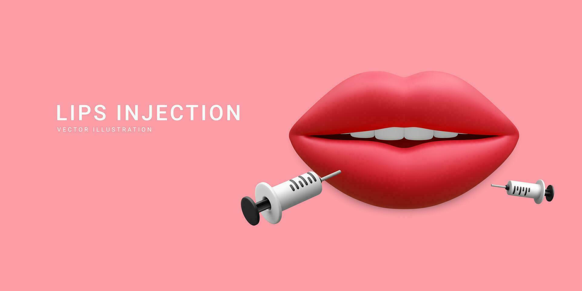 3d realistic banner for lip injection. Concept of dermatology and cosmetology treatment. Red aesthetic beautiful lips with medical plastic syringe with cosmetic injection in cartoon style vector