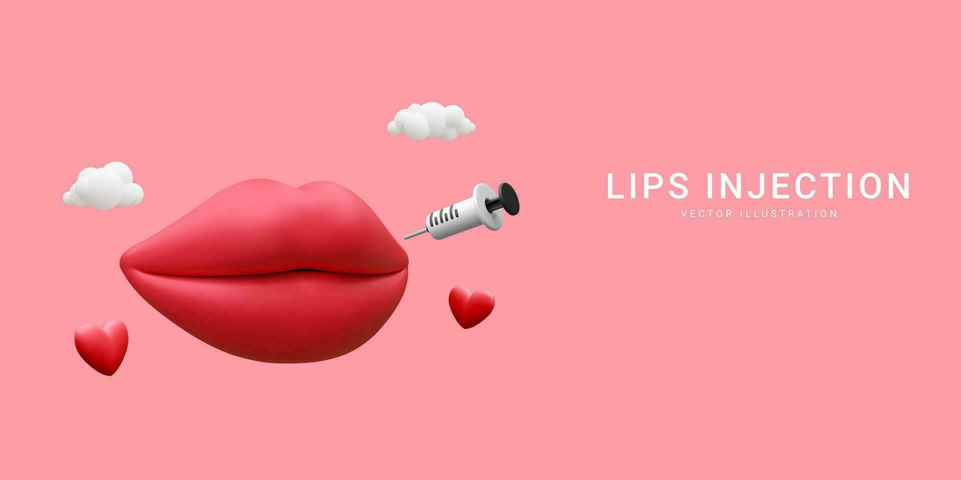 3d realistic banner for lip injection. Concept of dermatology and cosmetology treatment. Red aesthetic beautiful lips with medical plastic syringe with cosmetic injection in cartoon style vector