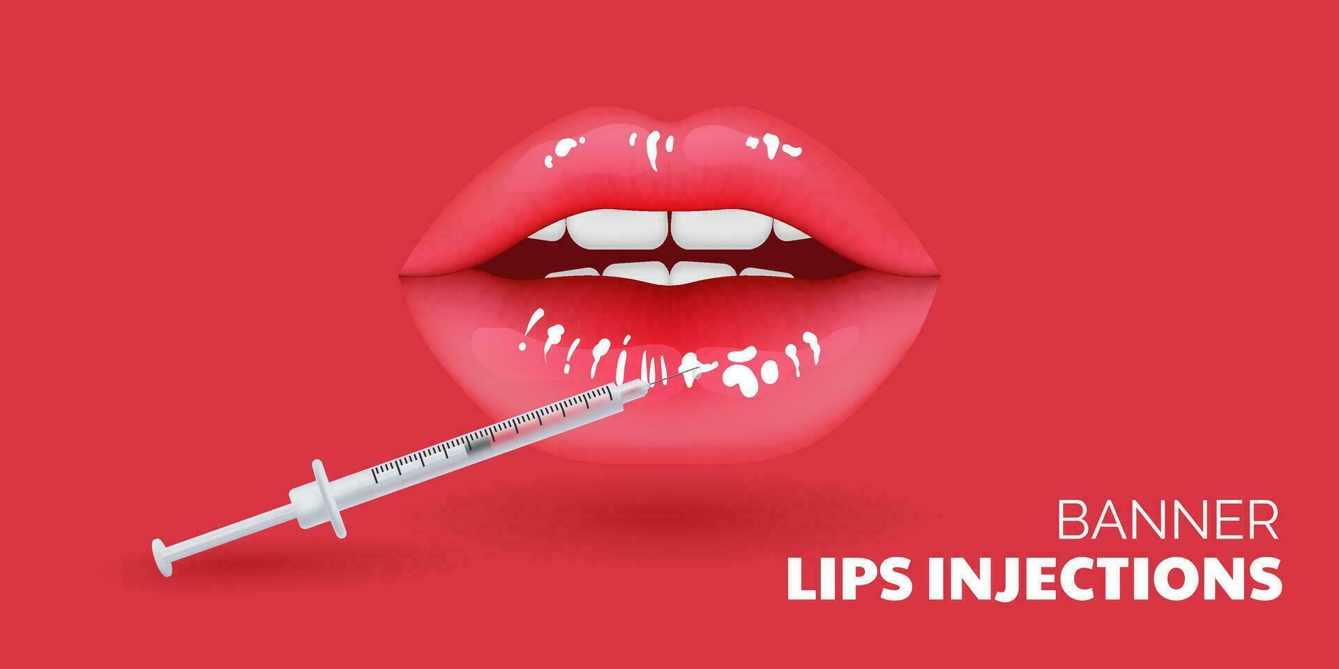 3d ilustración de realista labios pasando un cosmético procedimiento para envejecimiento cuidado. belleza clínica concepto vitrinas el corrección y contorneado de labios utilizando rellenos inyecciones ideal para salud cuidado vector