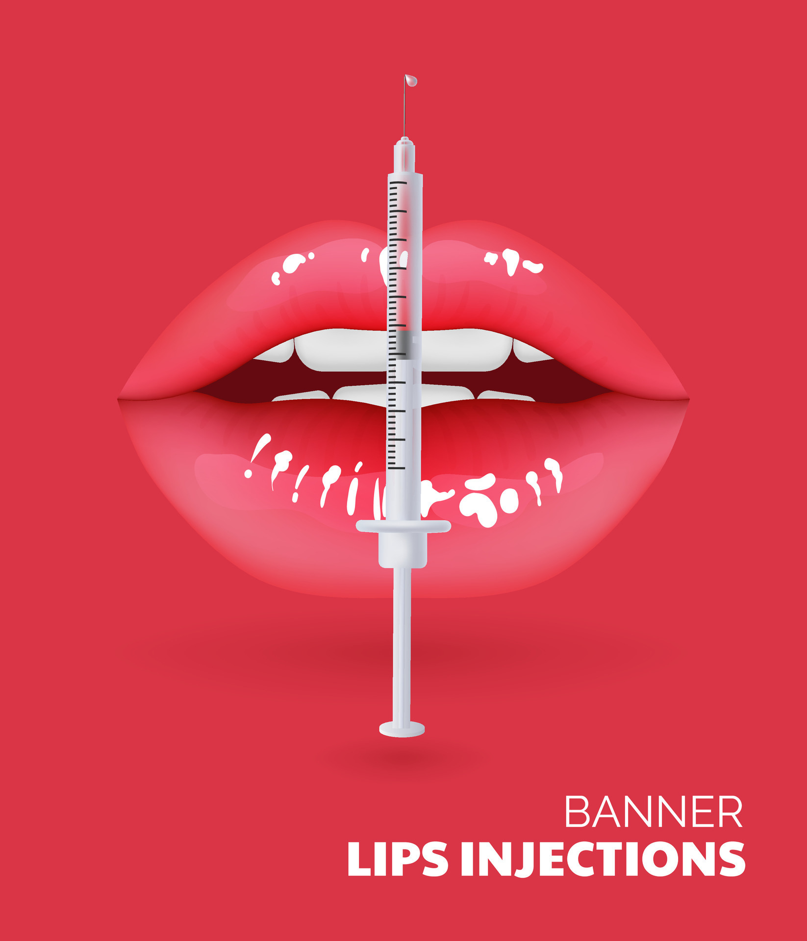 3D illustration of realistic lips undergoing a cosmetic procedure for