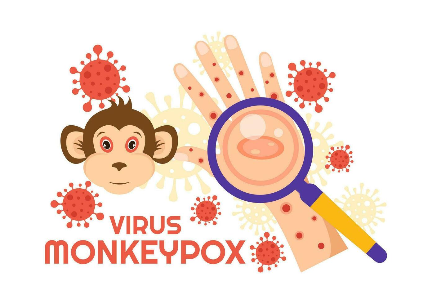 mono viruela brote vector ilustración de virus síntomas en humanos viruela del simio microbiológico en plano dibujos animados mano dibujado plantillas