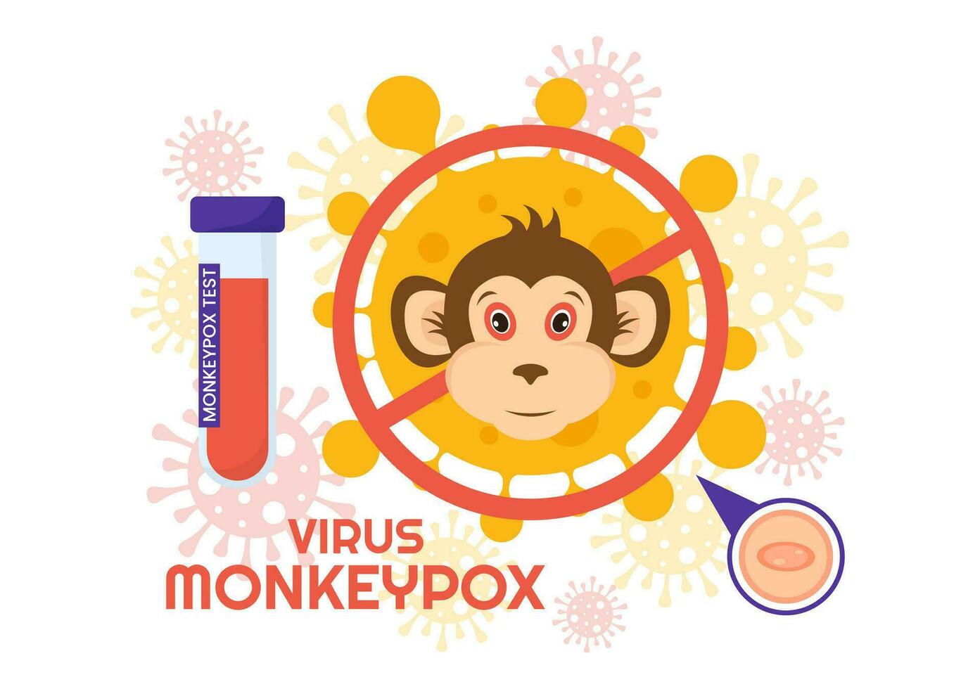 Monkey Pox Outbreak Vector Illustration of Virus Symptoms in Humans Monkeypox Microbiological in Flat Cartoon Hand Drawn Templates