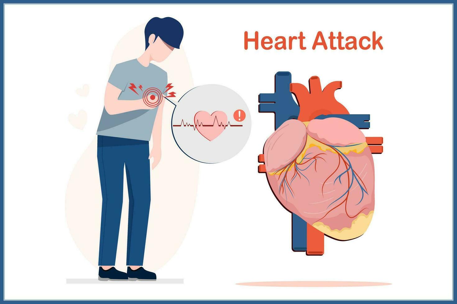 The young man wore a gray shirt and dark blue pants. Man standing showing chest pain signifying heart disease. Red text Heart. attack.and human heart in flat vector