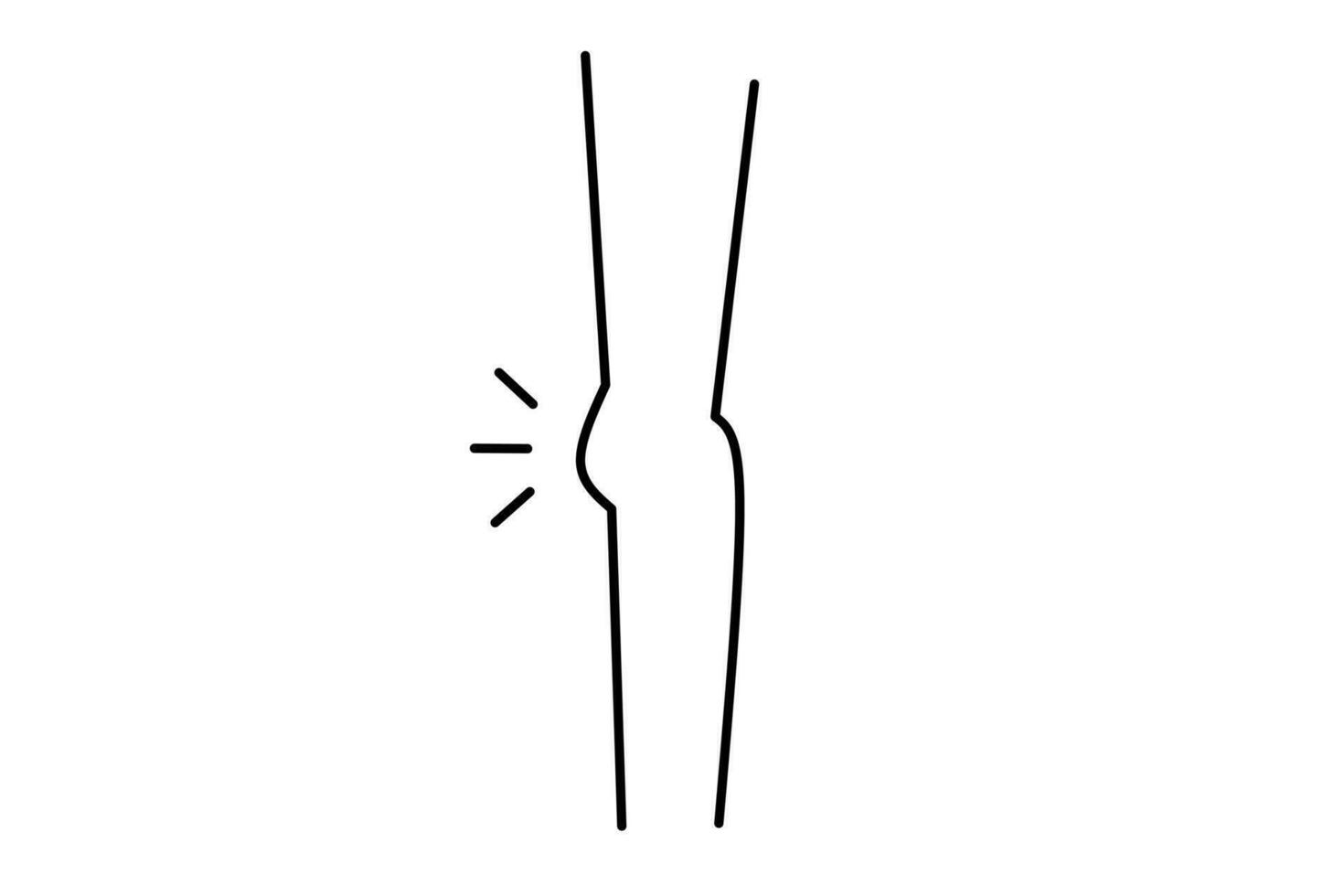 knee line drawing isolated on white background. Vector illustration.