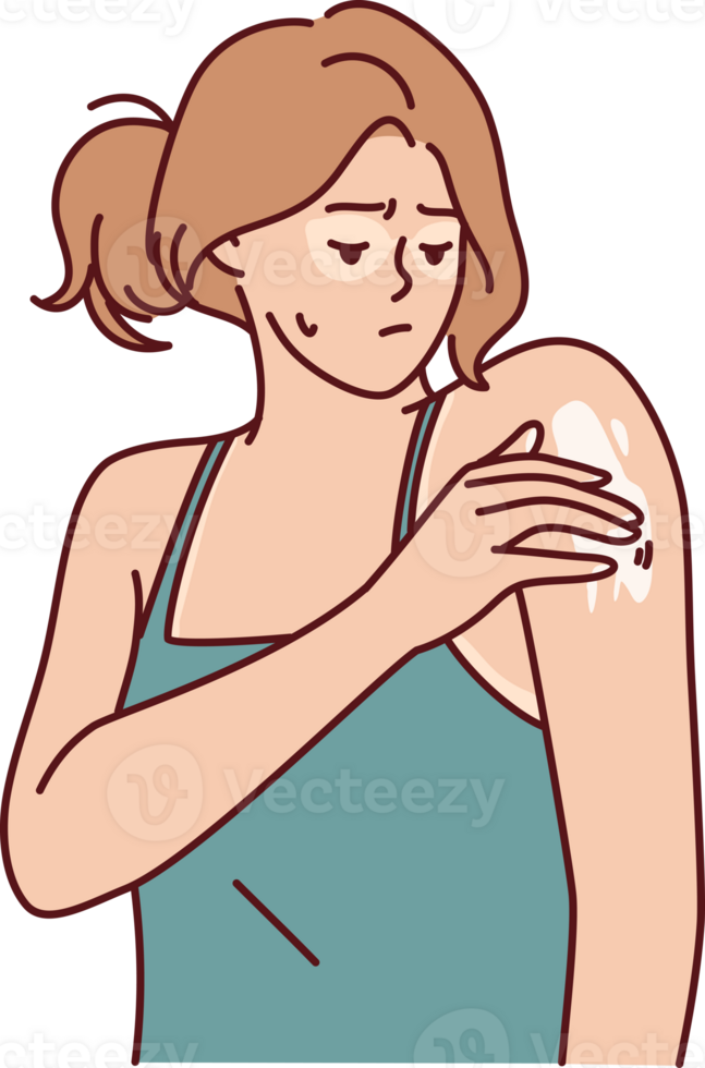 Woman with sunburn applies healing cream on shoulder to repair skin after exposure to ultraviolet png