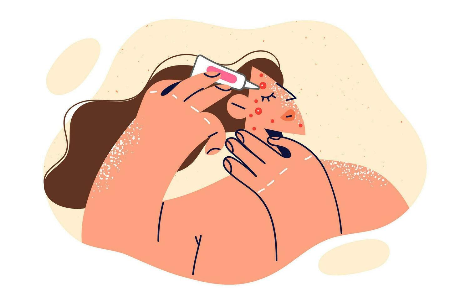 Woman applies cream to pimple on face, fights rash or redness associated with puberty. Girl uses cosmetics to fight acne and takes care of skin, wanting become attractive and like men vector