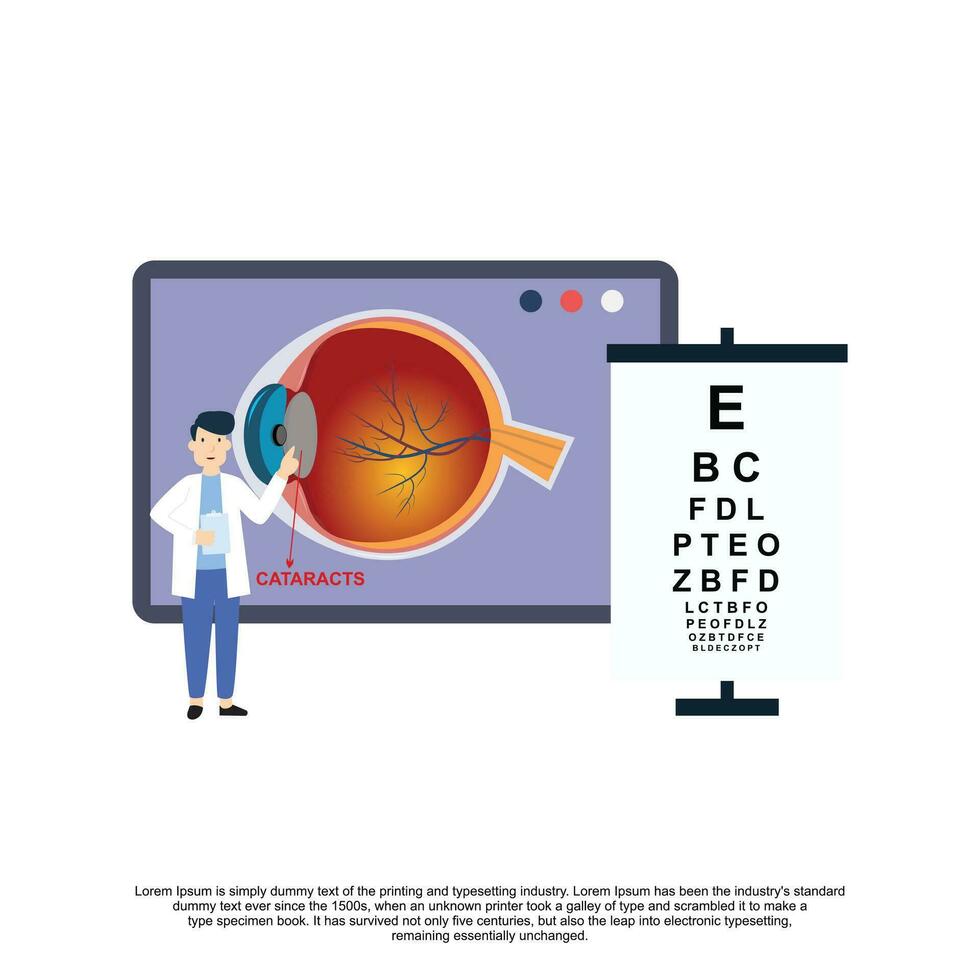 Cataract vector illustration in flat style
