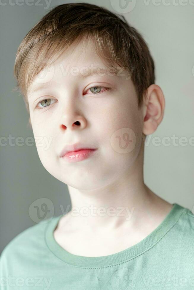 retrato de un chico de europeo apariencia con un rojo ojo desde conjuntivitis, en un blanco antecedentes foto