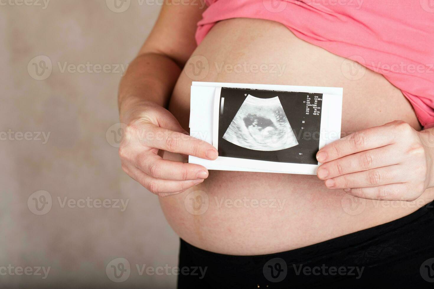 Young pregnant woman keeps USG image of her baby. photo