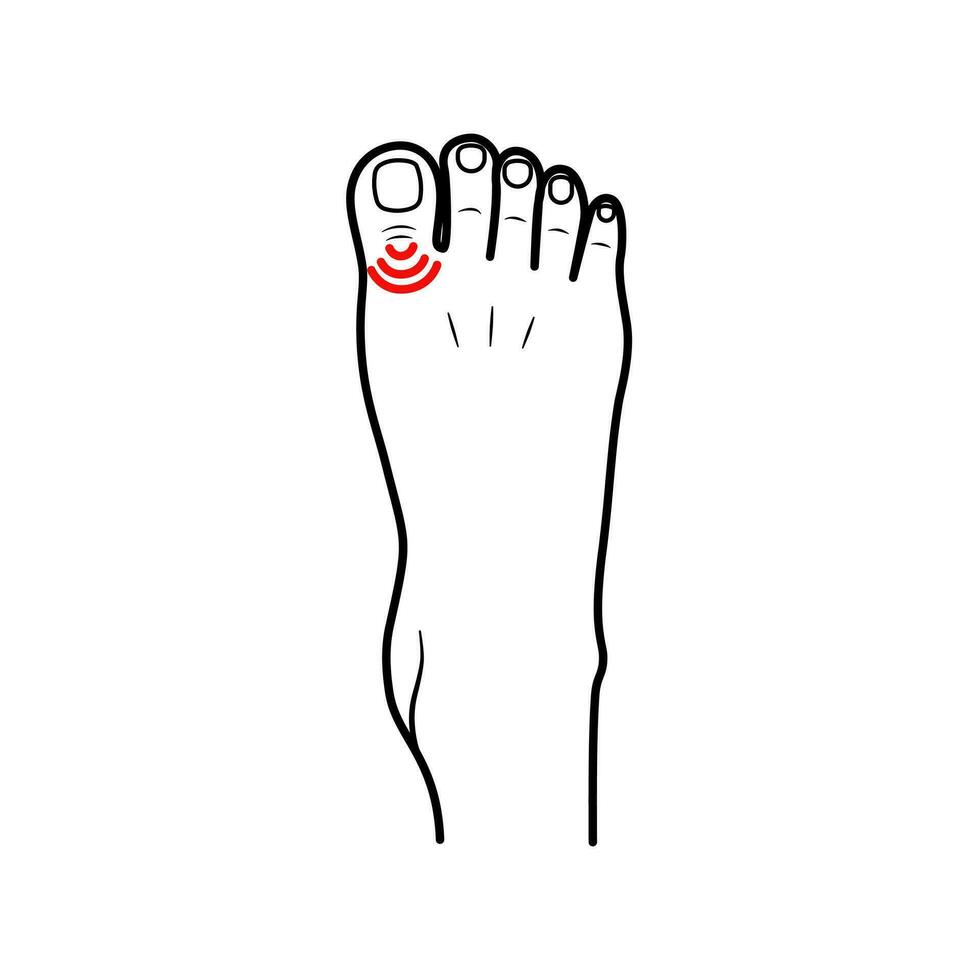 plano diseño de salud dolor y cuerpo lesión en el dedo del pie área, sensación dolor en el pies, dedos de los pies. vector ilustración eps 10