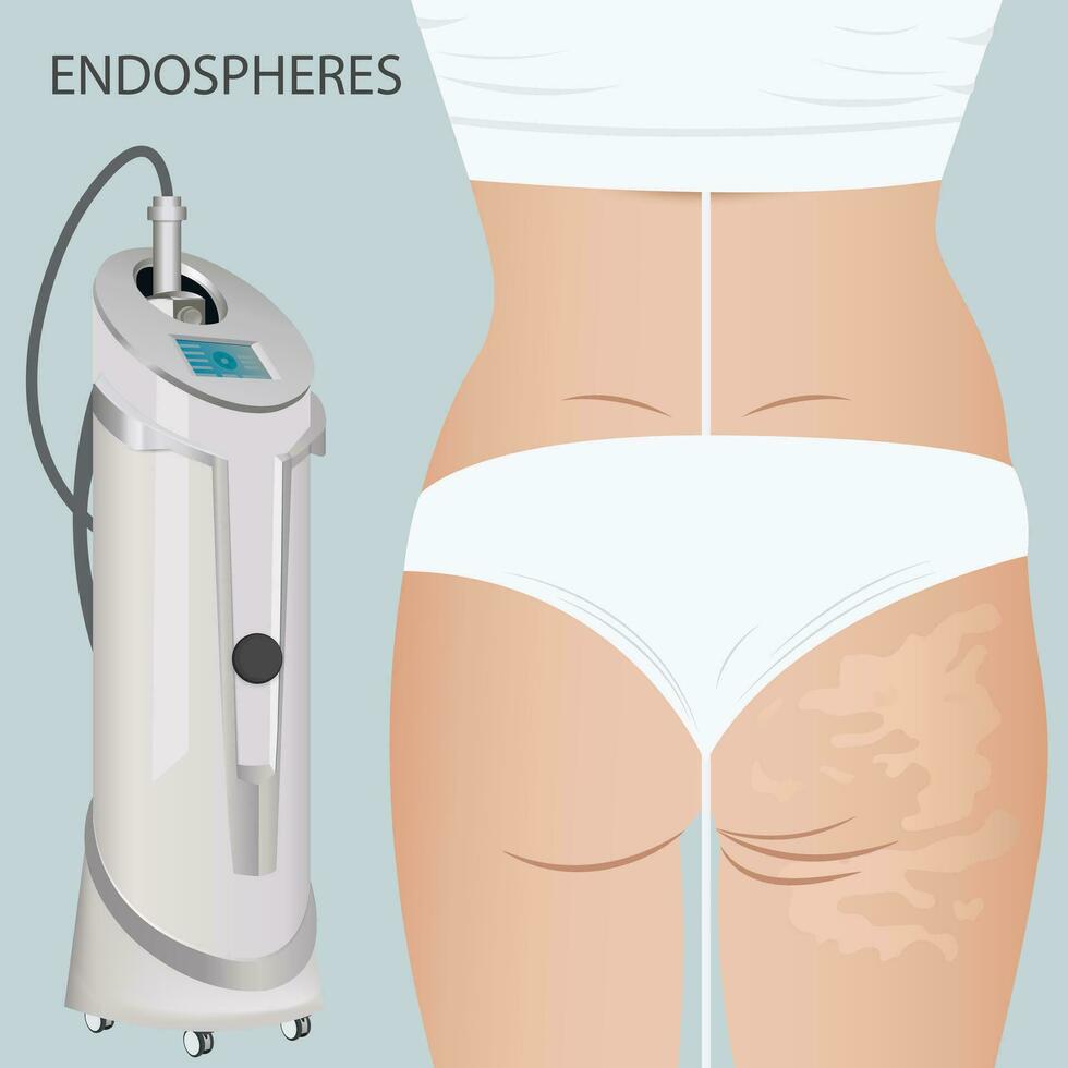 Deep cellulite reduction Body contouring Lifting with Endospheres apparatus. Physiotherapy, lymphatic drainage vector