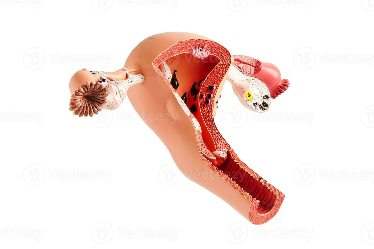 Uterus model isolated on white background with clipping path, doctor holding anatomy model for study diagnosis and treatment in hospital. photo