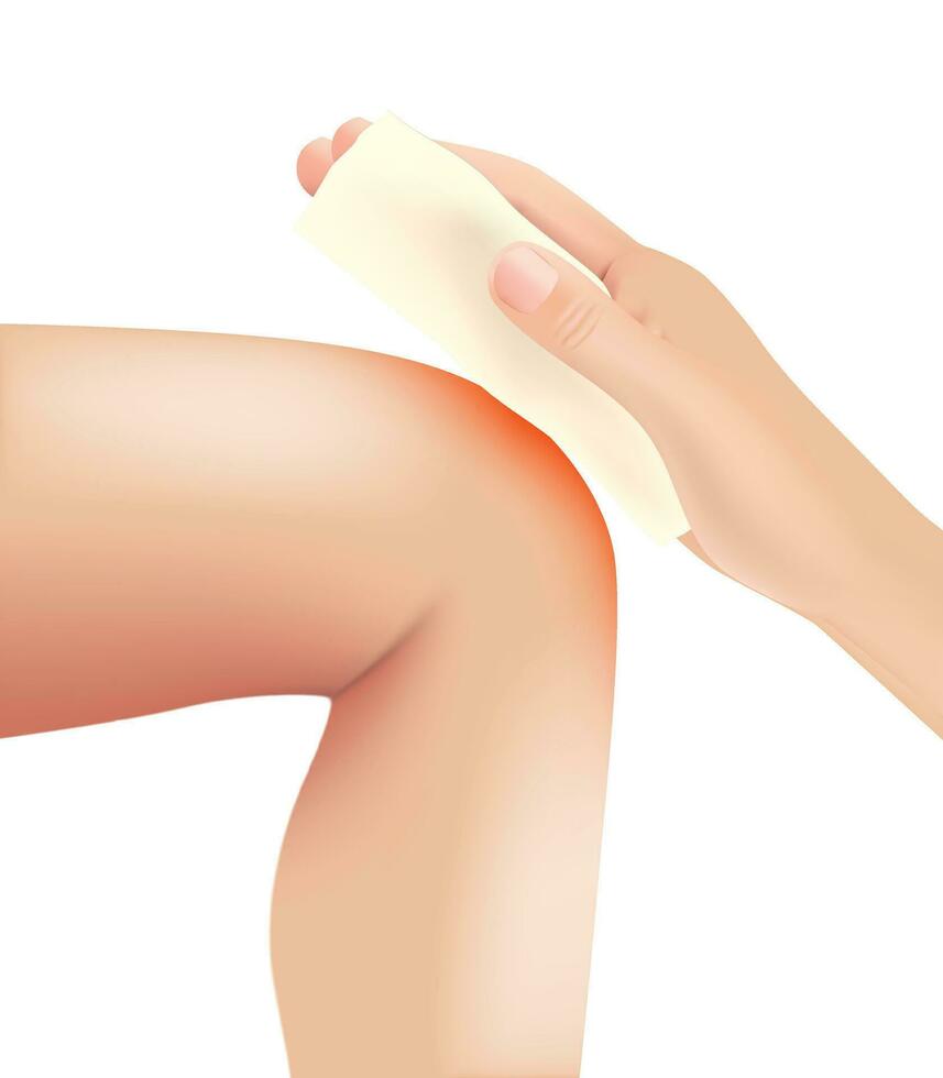 Skin burn injury treatment. First aid for burn wound vector illustration, knee with skin injury. vector illustration. EPS10.