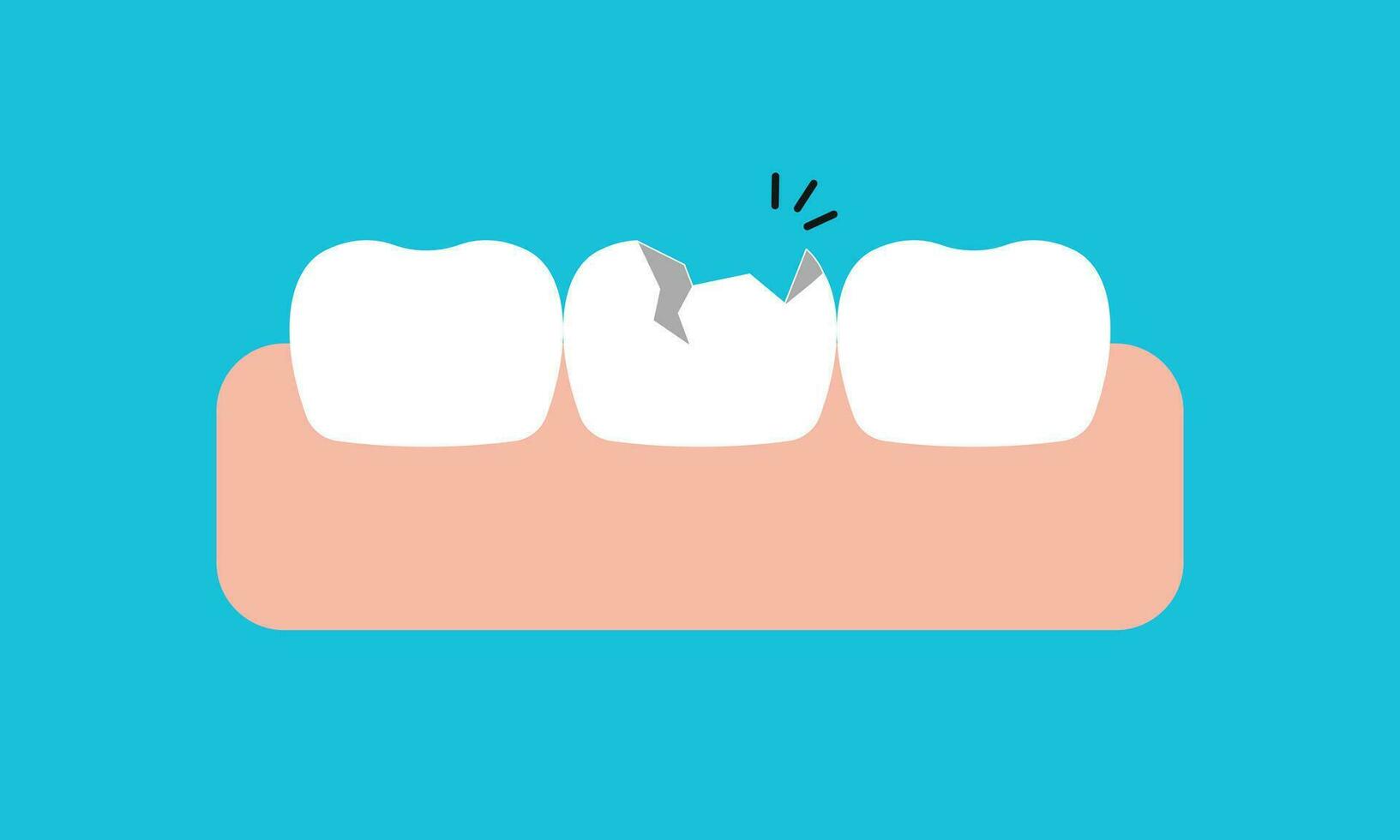 roto blanco dientes y cena ilustración vector diseño en azul antecedentes. dental cuidado concepto.