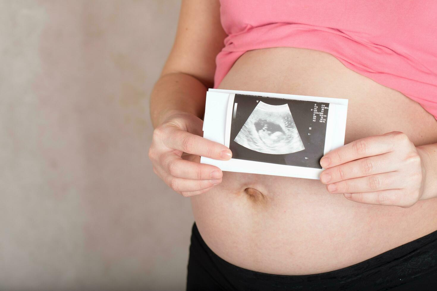 joven embarazada mujer mantiene usg imagen de su bebé. foto