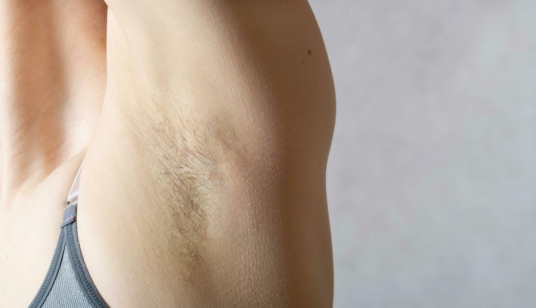 Underarm hair before depilation. Closeup photo