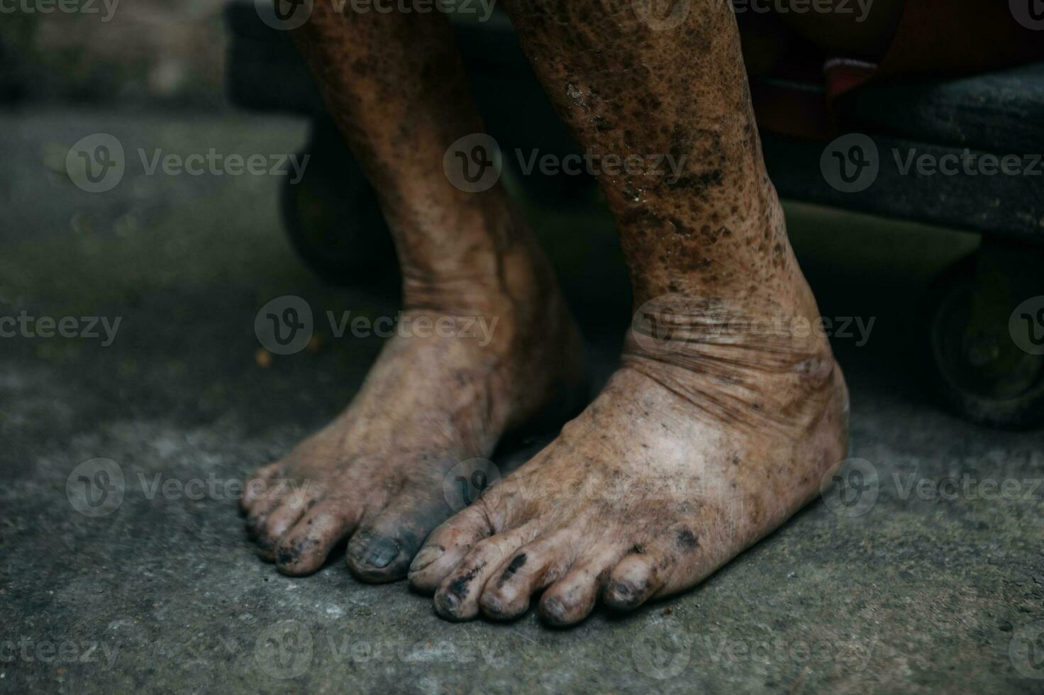 Close up of male wrinkled hands, old man is wearing  skin disease and anxiety Copy space. photo