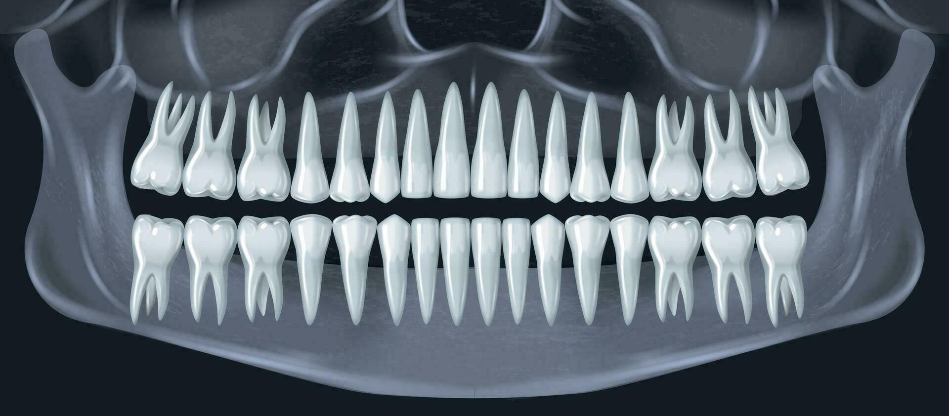 realista dientes radiografía vector