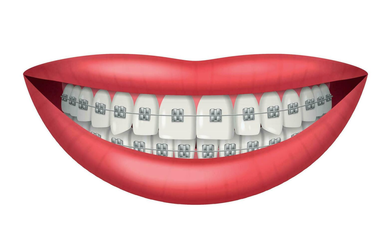 Teeth Braces Realistic vector