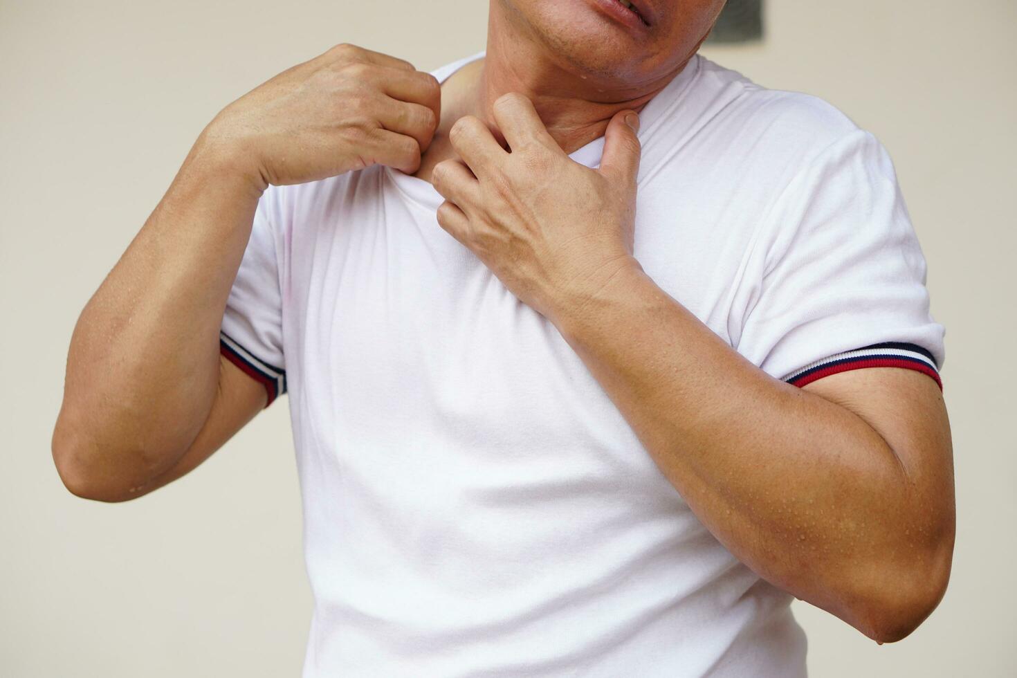 Closeup Asian man feels hot and itchy, scratch his neck. Concept uncomfortable feeling that come with hot weather. Irritated skin. Dermatitis, skin diseases. Health problem. photo