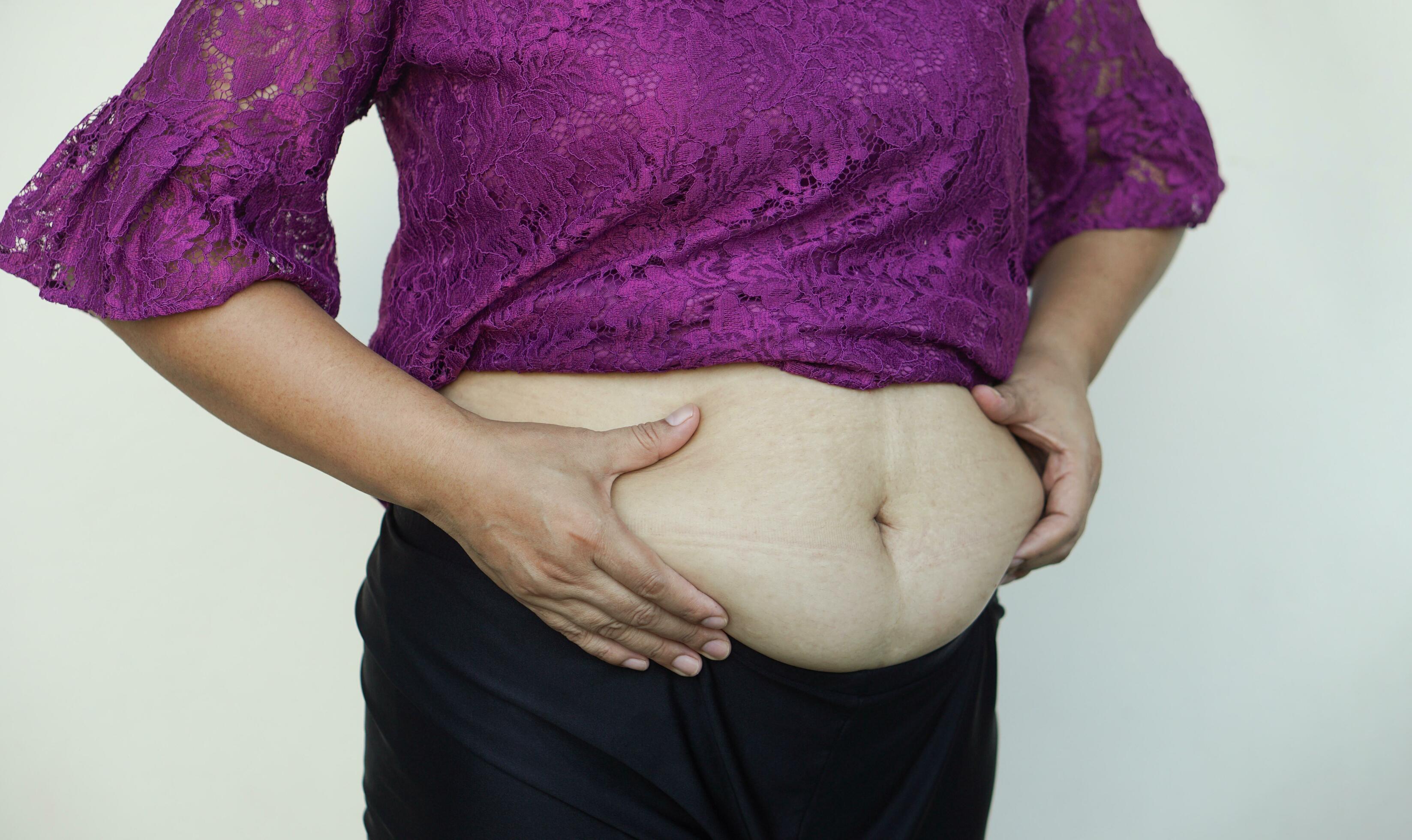 Closeup woman hands touch big belly, fat with cellulite abdomen