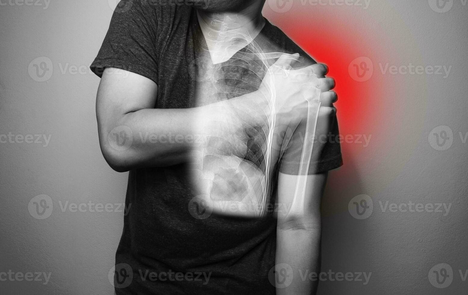 Close up Shoulder and humerus bone fracture pain in a man, Young man holding his shoulder in pain Shoulder inflammation symptoms medical healthcare concept. photo