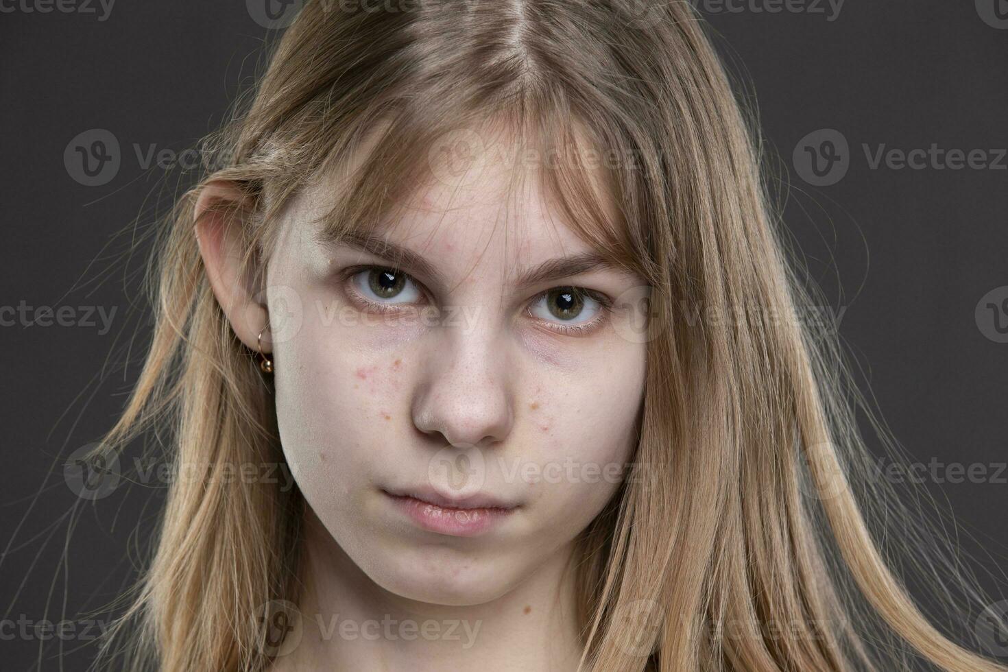 The face of a teenage girl with pimples close-up on a gray background. photo