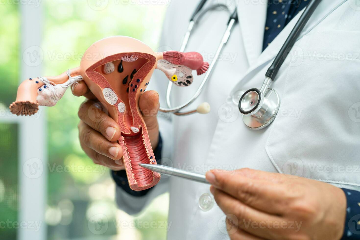 Uterus, doctor holding anatomy model for study diagnosis and treatment in hospital. photo