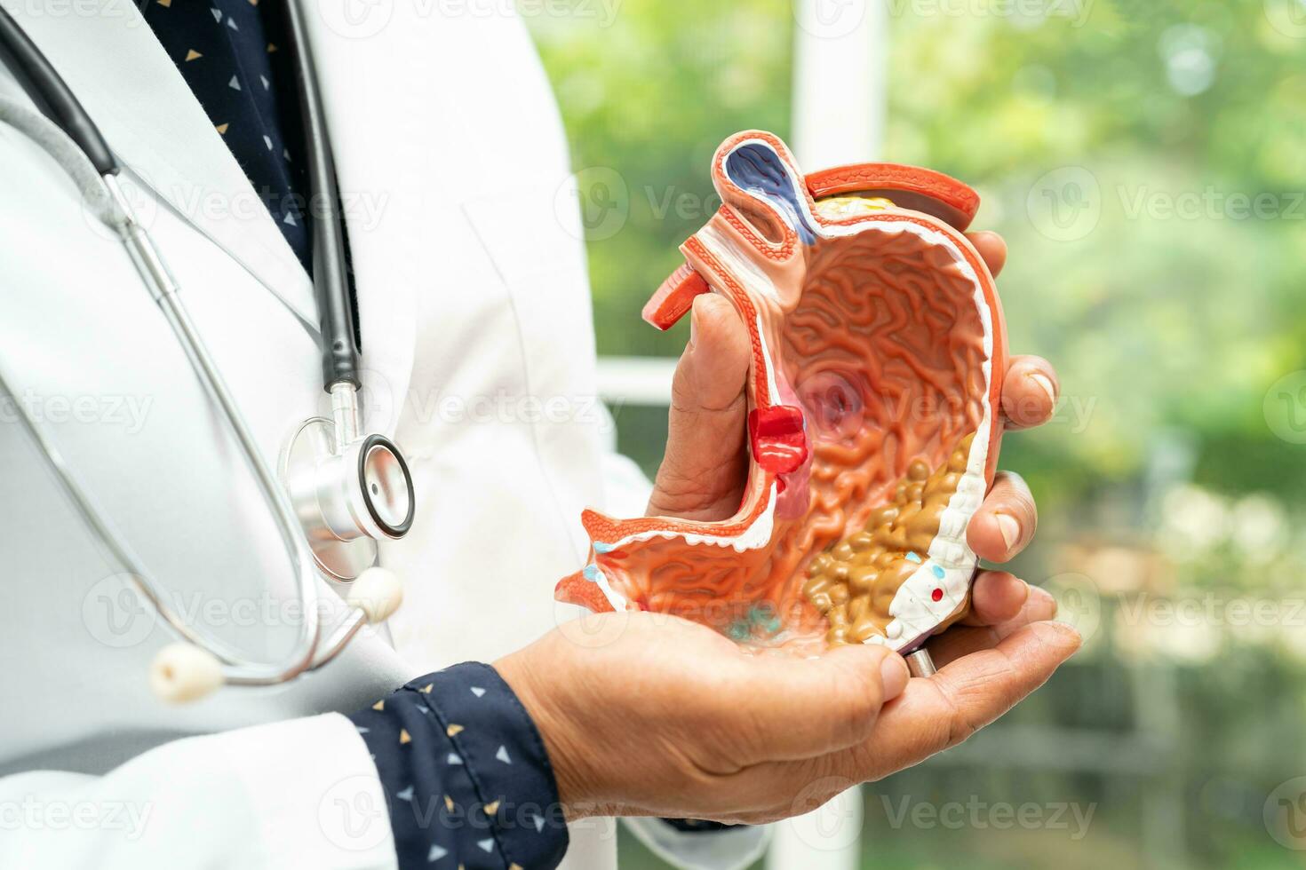 Stomach disease, doctor holding anatomy model for study diagnosis and treatment in hospital. photo