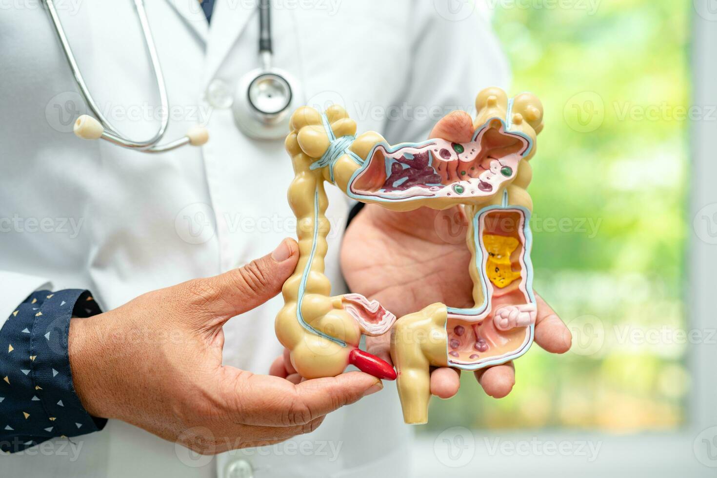 Intestine, appendix and digestive system, doctor holding anatomy model for study diagnosis and treatment in hospital. photo