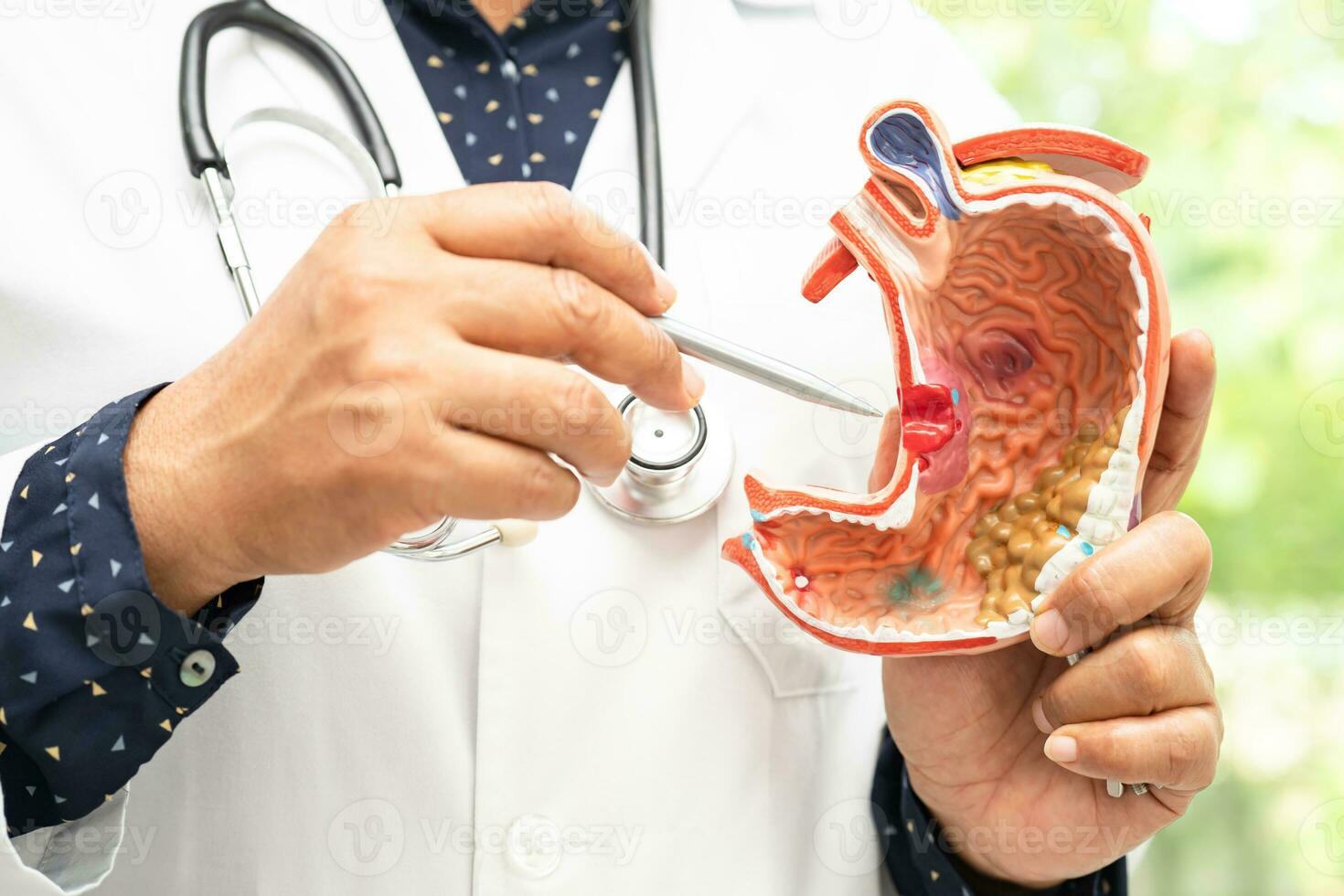 Stomach disease, doctor holding anatomy model for study diagnosis and treatment in hospital. photo